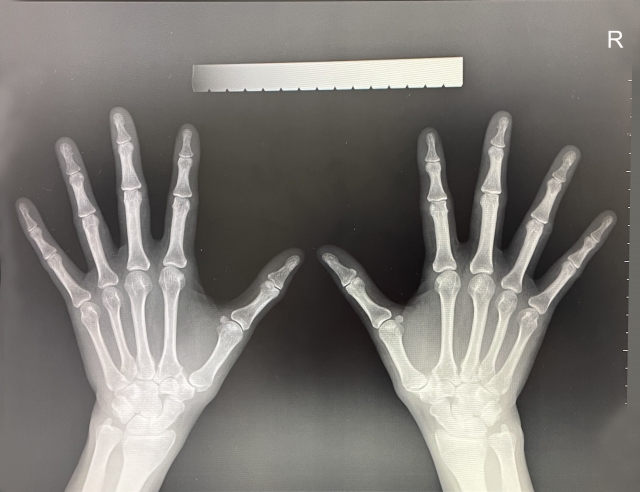 X線検査の写真